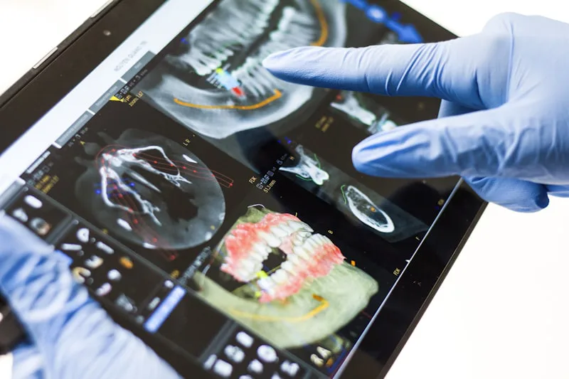Planejamento digital do sorriso em escaneamento 3D