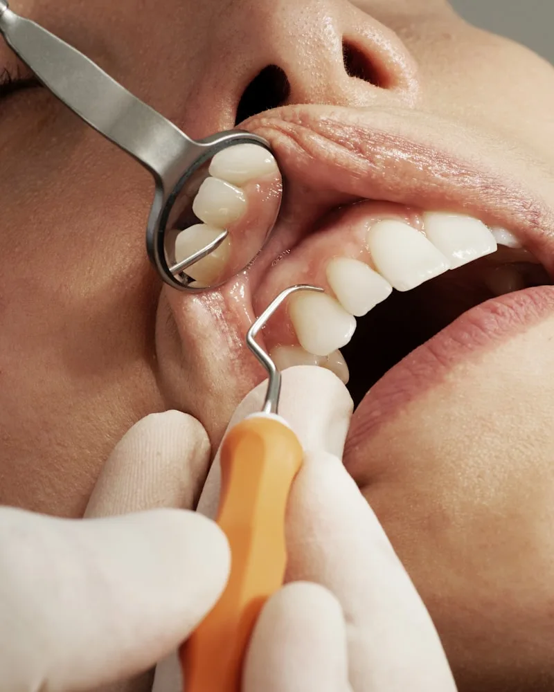 Odontologia preventiva